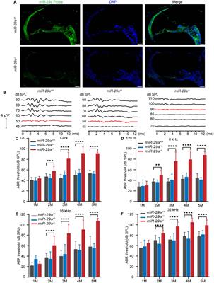 MiR-29a-deficiency causes thickening of the basilar membrane and age-related hearing loss by upregulating collagen IV and laminin